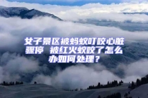 女子景區(qū)被螞蟻叮咬心臟驟停 被紅火蟻咬了怎么辦如何處理？